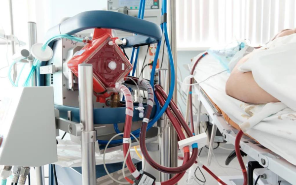 熱點(diǎn) | 填補(bǔ)國產(chǎn)空白，ECMO迎來&ldquo;中國造&rdquo;